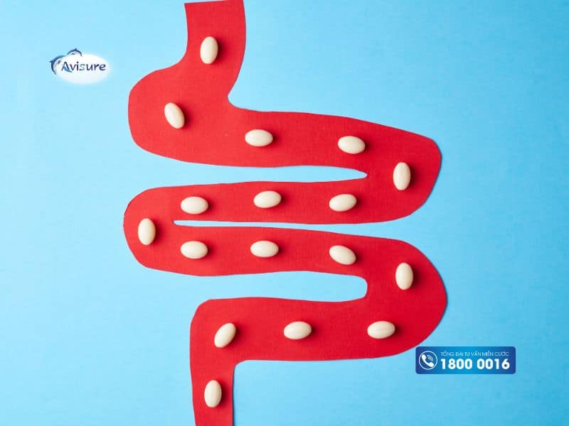 Những lưu ý khi bổ sung Probiotic cho cơ thể